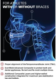 Tapout 护齿套牙齿保护 (2 件) TOMP001